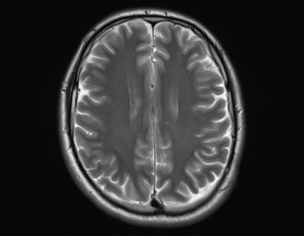 LmaiosDicomViewer - Gemaakt door PostDICOM